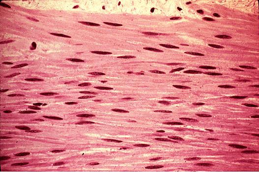 Smooth Muscle Tissue Do not have striations. Cells are shorter than skeletal muscle and are spindle shaped, each with a centrally located nucleus.