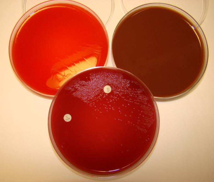 Sample 4/2010. Primary culture (Clostridium innocuum) 1 2 3 Aerotolerans test: 1. blood agar / aerobe: no growth 2.