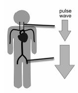 Transmission of systolic pressure to the