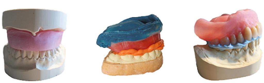 Full Dentures Scan and design single arch dentures Scan and design dentures for single arch including adapting the design to the antagonist.