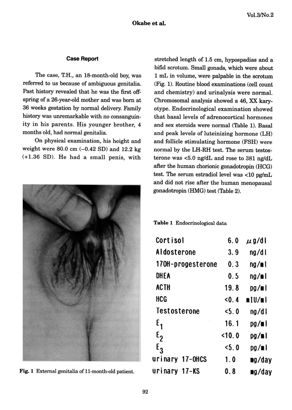 Vol.3/No.2 Okabe et al. Case Report The case, T.H., an 18-month-old boy, was referred to us because of ambiguous genitalia.