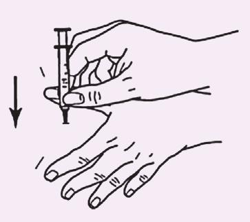 DIABETES CARE: How to Give an Insulin Injection Select the Site for the Shot 2 Pinch up and hold the skin of the site with one hand.