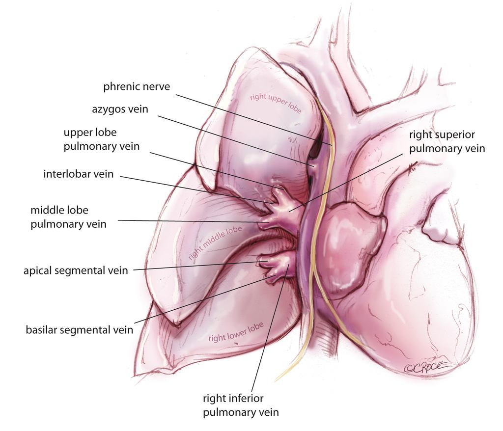 186 Yan. Thoracoscopic lobectomy and segmentectomy Figure 3 Segmental anatomy of the pulmonary veins viewed from the anterior hilum.