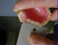 The inclination of maxillary molars are mesially and slightly lingually to create a 6 degree upward curve. 2.