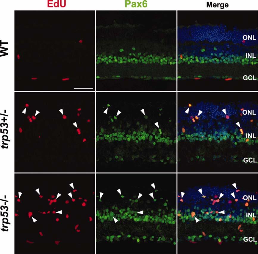 1584 UEKI ET AL. Fig. 3. Loss of trp53 stimulates cell proliferation in adult retinal explants with EGF treatment for 5 days.