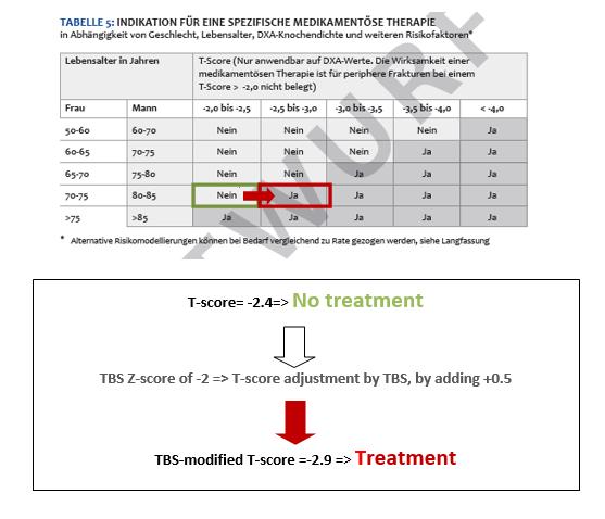 TBS into International Guidelines German DVO A-73 year-old woman with a BMD T-score of -2.