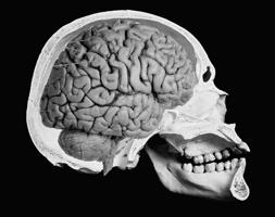 The brain is protected from injury by The skull enough