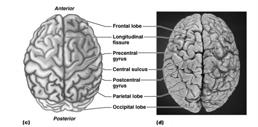The Cerebral Hemispheres Sulci shallow grooves on the surface of the cerebral hemispheres, does not contain dura mater in the sulci Several deep sulci define the lobes (which are named according to