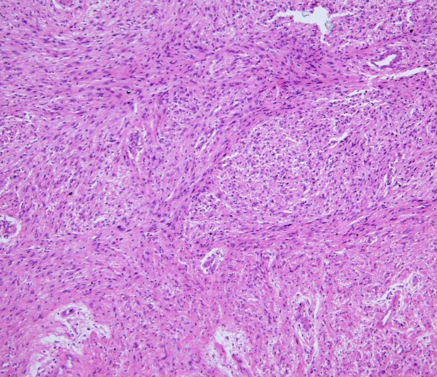 Case 3 Clinical history : 34 years-old male, with a 5 cm