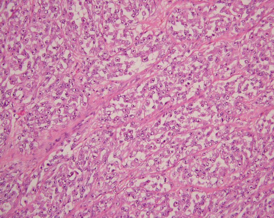 Case 12 Clinical history: Female, 46.