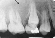 radiographic appearance, the patient s age,