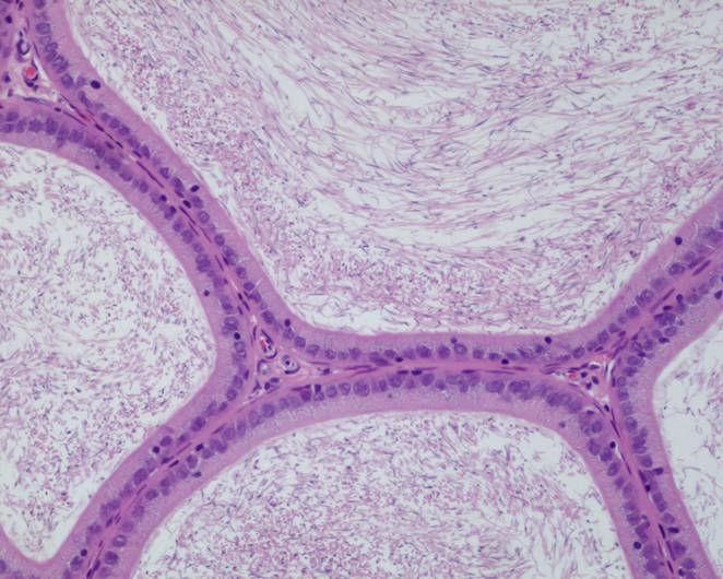 The caput epithelium (left) secretes protein that is important in sperm maturation while the cauda epithelium