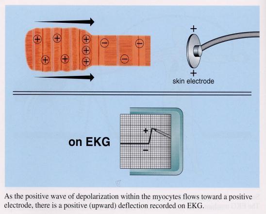A current of depolarization traveling towards the + electrode is recorded as a positive deflection A current of depolarization traveling away from the +