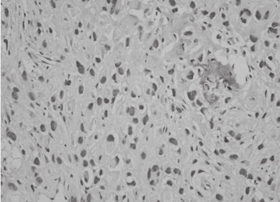Immunohistochemical stains were performed on unstained slides.