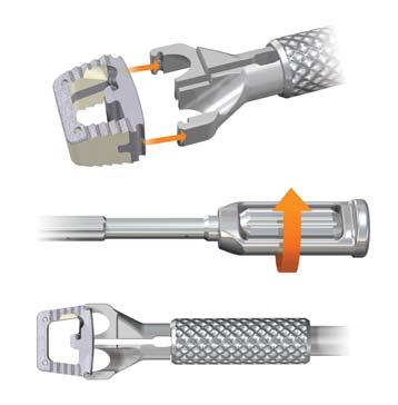 Veyron-C Anterior Cervical System Surgical Technique 13 Implant Loading Insertion Screw Hole Preparation - Awl Fig. 24 Fig. 25 Fig.