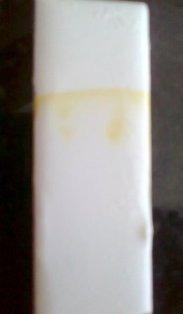 Fig.-1: Comparative Photographic image of Thin Layer Chromatography. A-Emu egg lecithin, B- Pure soy lecithin B C Fig.