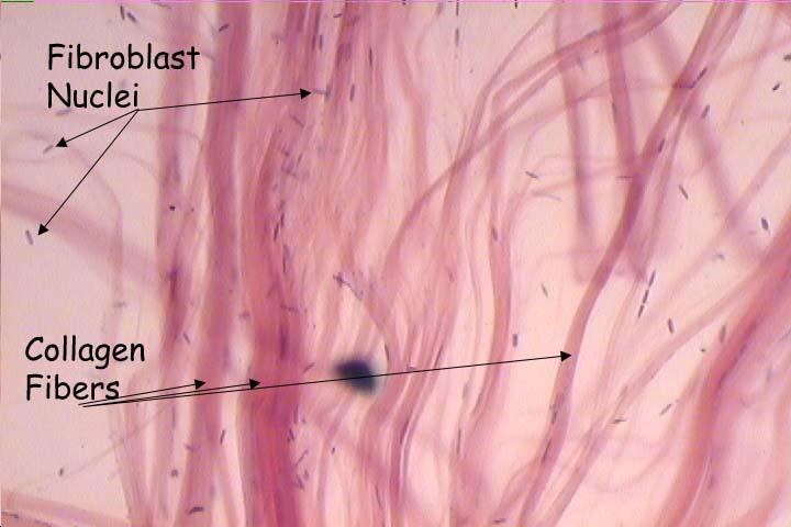 Dense Connective Tissue This tissue consists of densely packed collagenous fibers and is very strong but