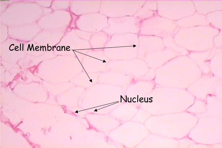 Adipose Tissue Fat storing connective tissue Found beneath the skin (insulates the body),
