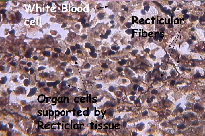 Reticular Connective Tissue Network of interwoven reticular