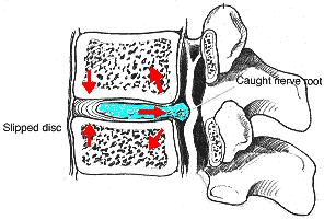 The Spine Station 6 26 Bones Called Vertebrae 7 Cervical Neck 12 Thoracic Chest 5