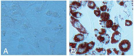 5. Data Analysis A. Cell Staining An example of typical staining of differentiated adipocytes obtained using this kit is shown in the figure below.