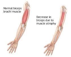 Muscle tone NUMBER OF MUSCLE FIBERS ACTIVATED The normal tension and firmness of a muscle at rest Muscle units