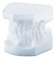 Orthodontic study / demonstration models Orthodontic study model Angle