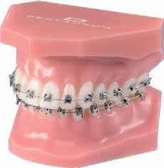 Orthodontic study / demonstration models discovery sl 2.0 McLaughlin-Bennett-Trevisi* 22 discovery sl 2.