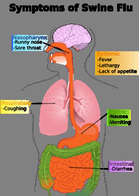 Symptoms of Swine Flu Nasopharynx -Runny