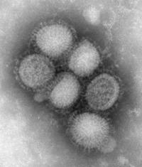 Electron microscope image of the reassorted H1N1