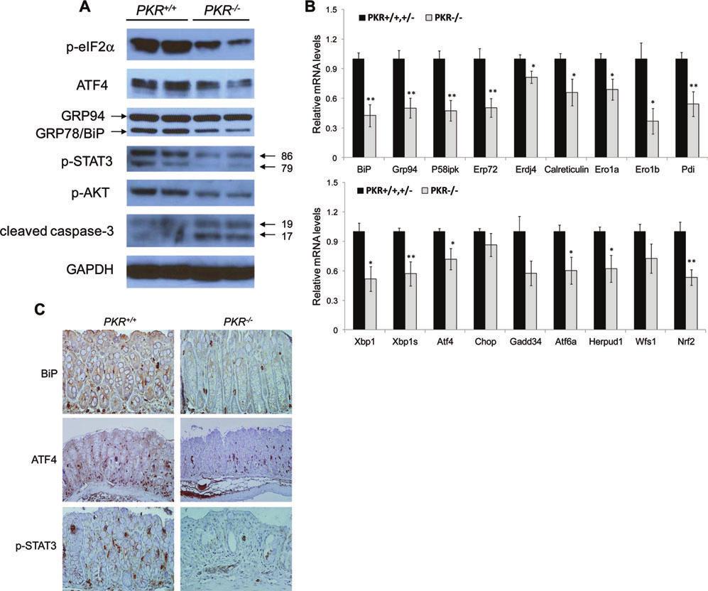 Cao et al Inflamm Bowel Dis Volume 18, Number 9, September 2012 FIGURE 3. PKR / mice show hyperactivated inflammatory response in the colon upon DSS administration.