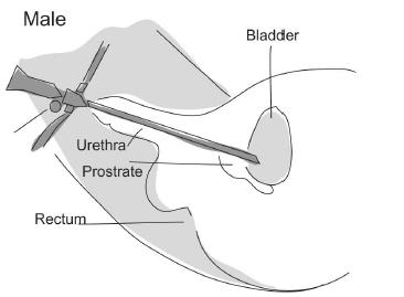 Page 2 of 5 Diagram of a telescope passing through the urethra into the bladder male Why do I need a cystoscopy and/or a urethroscopy Both cystoscopy and urethroscopy are performed to diagnose and