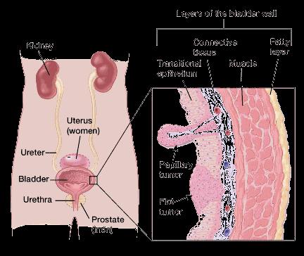 The wall of the bladder has 4 main layers. The innermost lining is called the urothelium or transitional epithelium.
