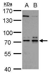 A. 30 μg GL261 whole cell lysate/extract B. 30 μg C8D30 whole cell lysate/extract C.