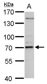 30 μg 293T whole cell lysate/extract B. 30 μg A431 whole cell lysate/extract 7.