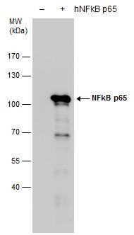 5 % SDS-PAGE Non-transfected (-) and NFkB p65 -transfected (+, including GFP-tag)