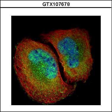 Sample(30 ug whole cell lysate) A:MOLT4 (GTX27912) 7.