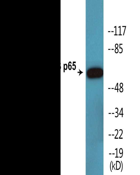 ANTIBODY SPECIFICITY Anti-NF-κB p65 (Phospho-Thr254) Antibody The Anti-NF-κB p65 (Phospho-Thr254) Antibody is a rabbit