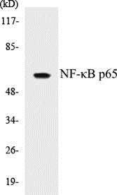 Anti-NF-κB p65 Antibody The Anti-NF-κB p65 Antibody is a rabbit polyclonal antibody. It was tested on Western Blots for specificity. The data in Figure 4 shows that a single protein band was detected.