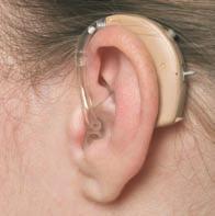 What different styles of hearing devices are available? Hearing devices come in a variety of styles. Each style has its own advantages and limitations.