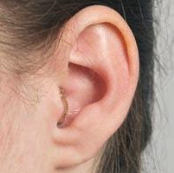 In-the-ear In-the-ear (ITE) hearing devices are custom designed and fit directly into your ear, filling most of the visible portion of your ear.
