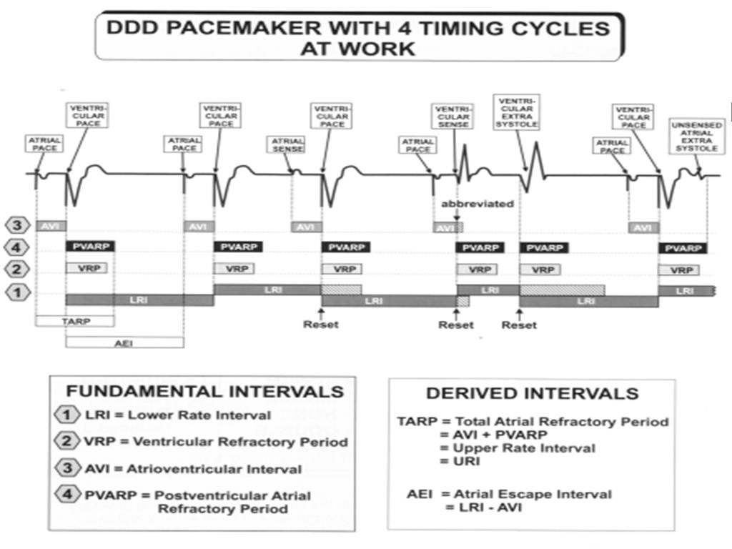 DDDR Pacing 37 DDDR Paces both Atrium and Ventricle DDDR Senses both Atrium and Ventricle DDDR 1.