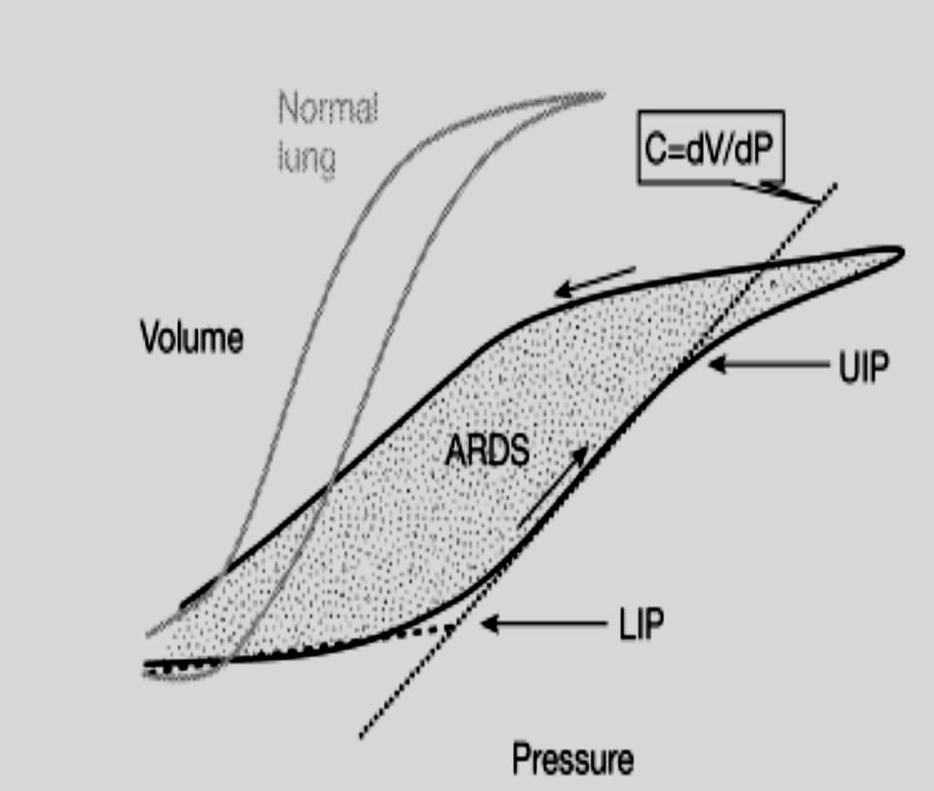 Pressure-volume loop Normal lung Compliance (C) is markedly reduced in the injured lung on the right as compared to the normal lung on the left ARDS Upper inflection point (UIP) above this pressure,