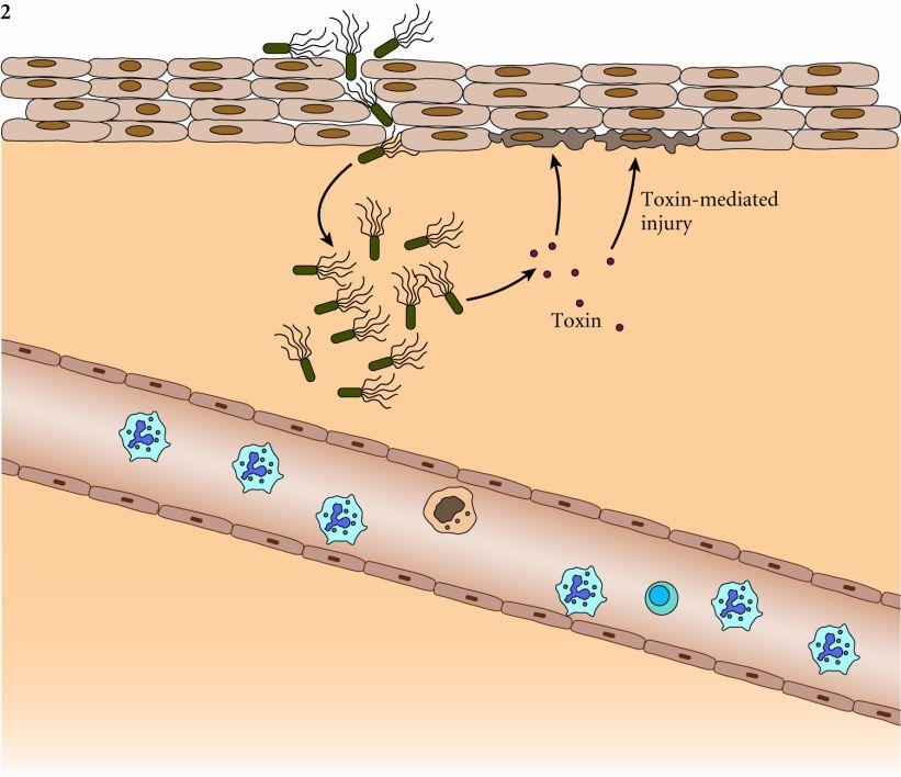 at bacterial surface Initiated by wound healing mechanisms All can activate complement pathways that alters