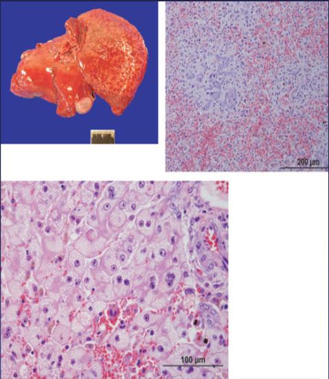 Hepatotoxicity Case 1 9 yr, FS Rottweiler 3 wks after ZON initiated: vomiting, inappetence, icterus ZON discontinued clinical recovery normal liver enzymes 8wks later
