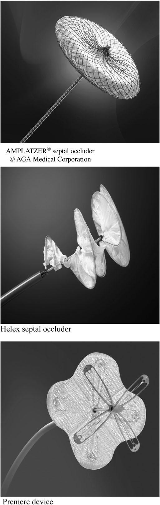 Anaesthesia for percutaneous closure Alternatively, the HELEX septal occluder may be used; this is more suitable for the closure of smaller ASDs.