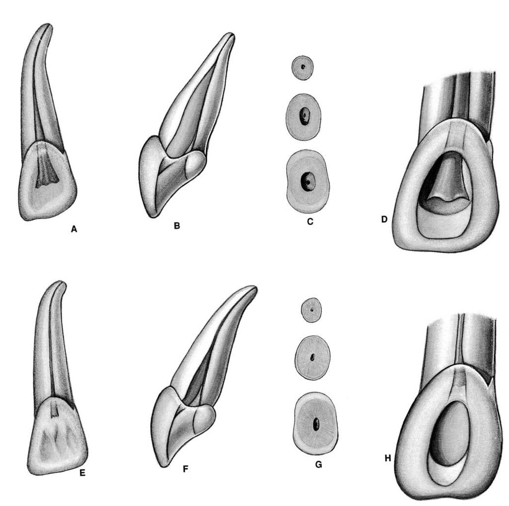 PLATE 5 Maxillary Lateral Incisors Length of tooth Canal Lateral canals Apical ramifications Root curvature Average Length 22.