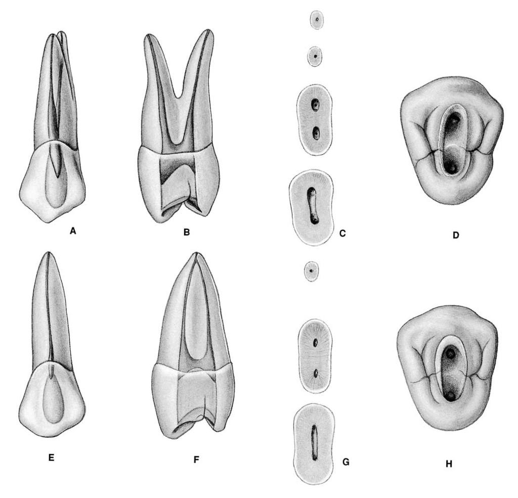 PLATE 13 Maxillary First Premolars Curvature of Roots Single Double Roots Length of tooth Canals Direction Root Buccal Palatal Average Length 21.