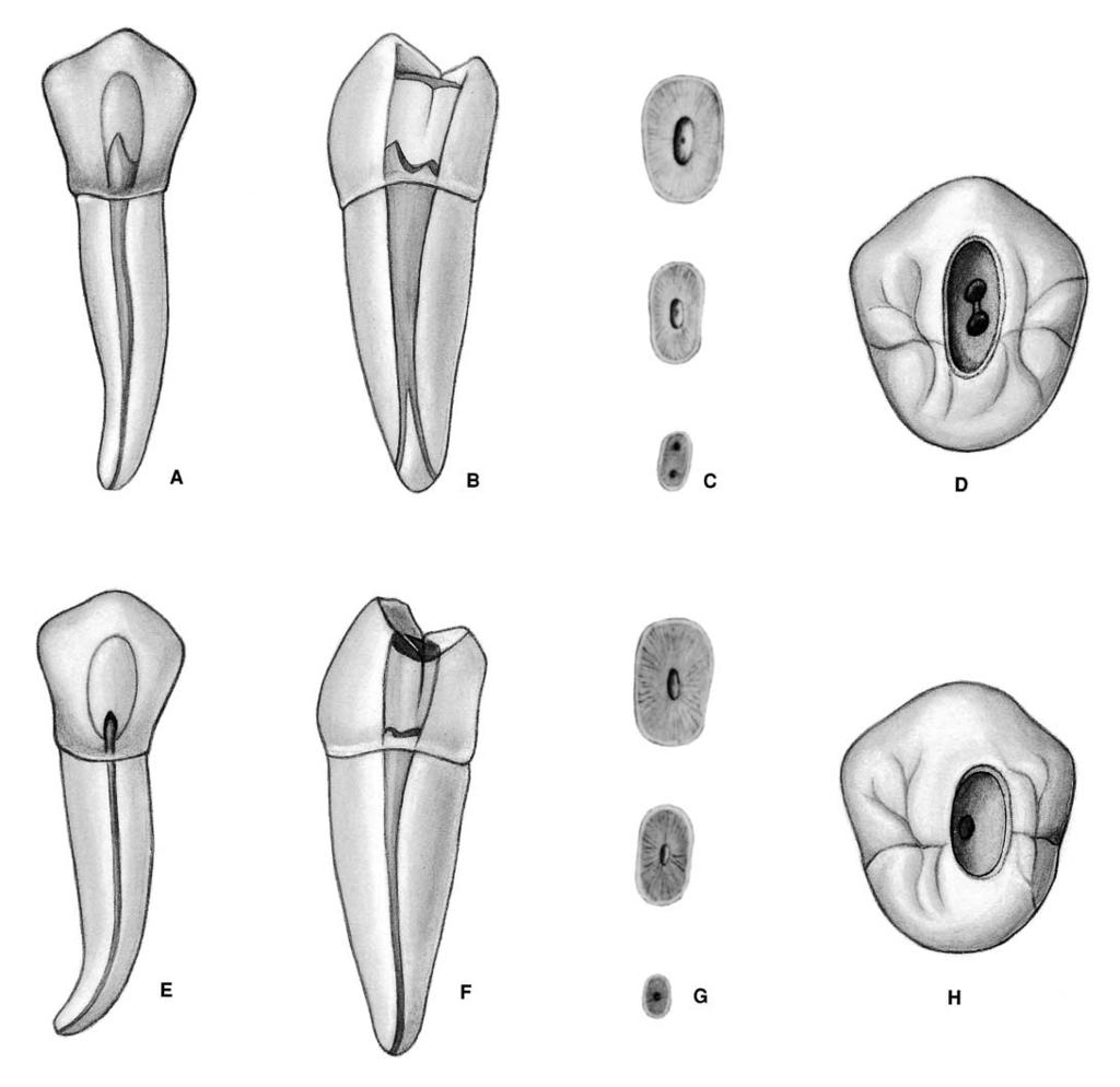 PLATE 18 Mandibular Second Premolars Length of tooth Canals Curvature of root Average Length 21.4 mm One canal 85.5% Straight 39% Lingual Curve 3% Maximum Length 23.