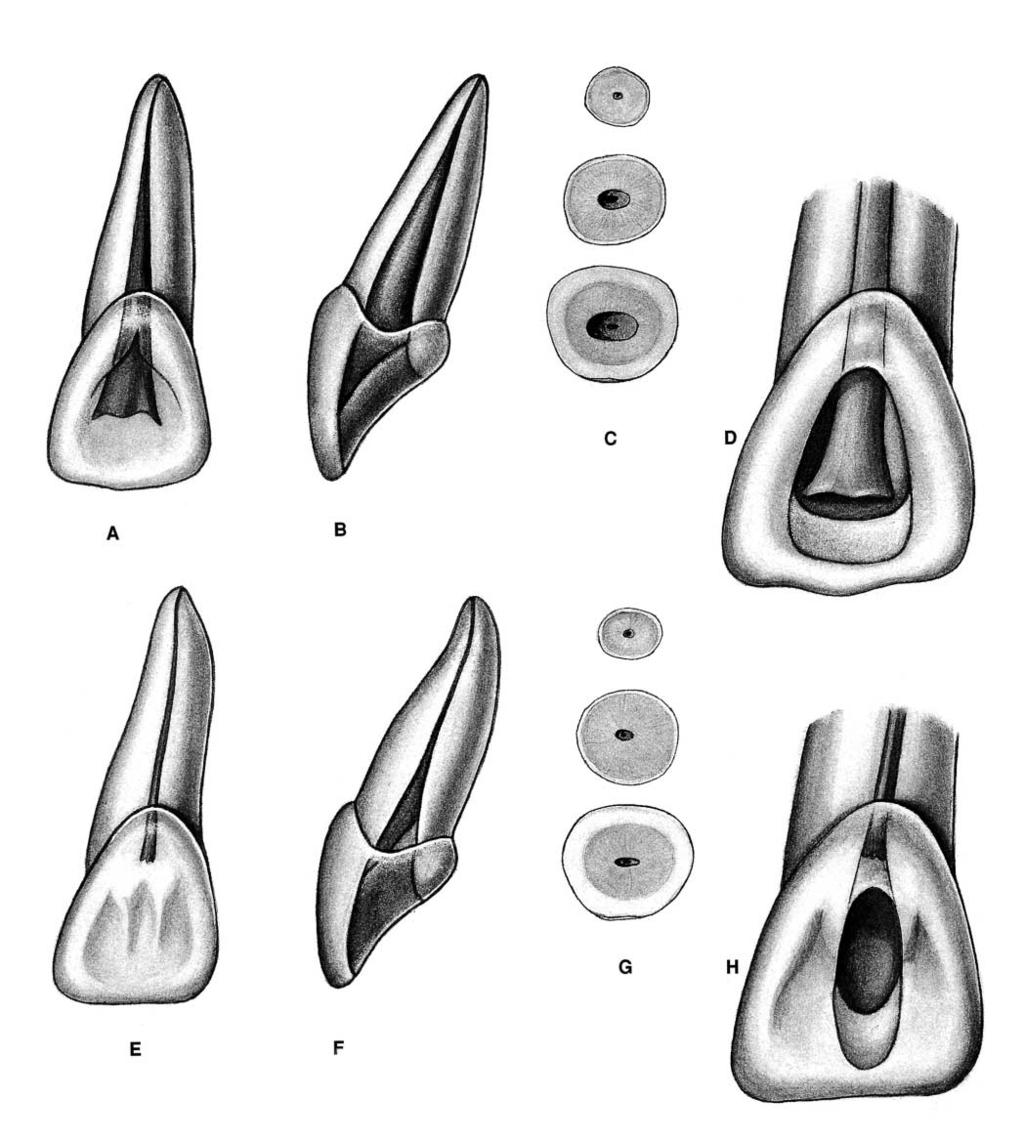 PLATE 4 Maxillary Central Incisors Length of tooth Canal Lateral canals Apical ramifications Root curvature Average Length 23.